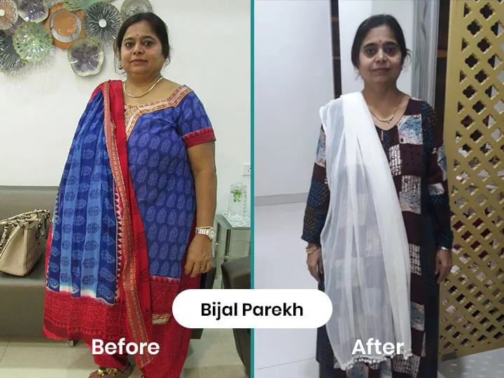Bijal Parekh